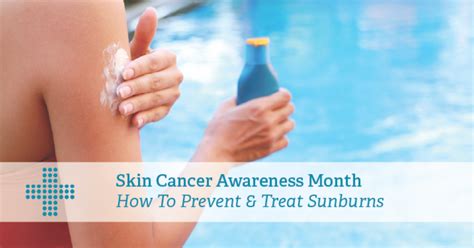 Skin Cancer Awareness Month Sunburns Patient Plus