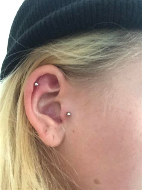 Got My Tragus And Helix Piercing Done Last Week Sunday The Swelling Is
