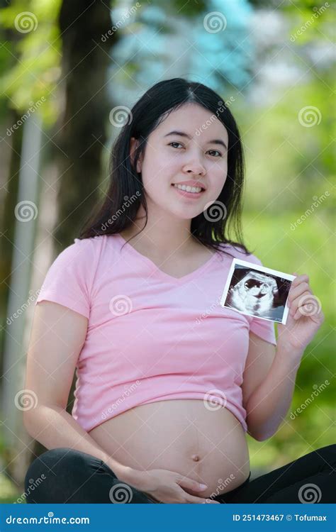 asian pregnant woman relax in the park stock image image of summer leisure 251473467