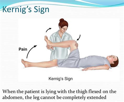 Kernig Sign Brudzinski Sign How To Perform Kernig And Brudzinski Test