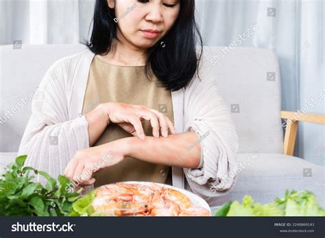Asian Woman Have Problems Itching Rashes Stock Photo 2248869143
