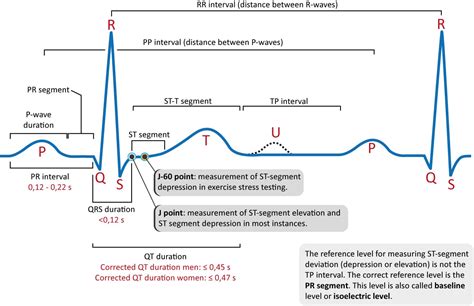 Overview of the ECG Waves, Deflections, Intervals, Durations - ECG & ECHO