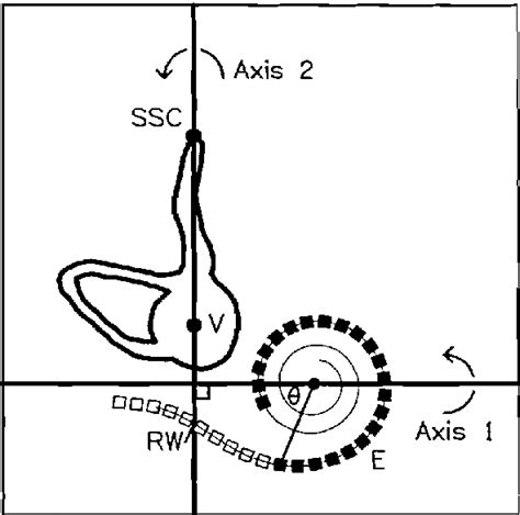 Diagram Of Radiograph Of Implanted Cochlea Outline Of Vestibular