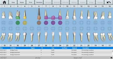 Printable Dental Charting Symbols
