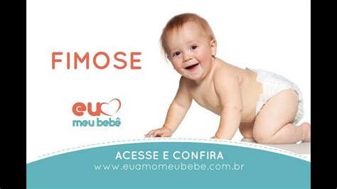Tipos De Fimose Infantil Fotos