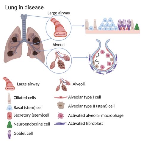 Lunge Stamceller I Helse Reparasjons Og Sykdom Eurostemcell Avenir