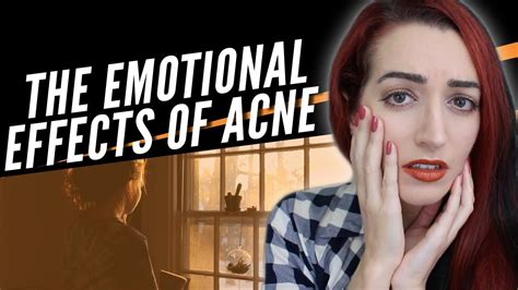 The Emotional Effects Of Acne Youtube