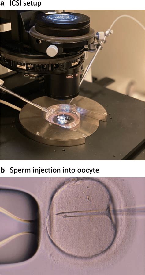 Intracytoplasmic Sperm Injection Icsi Procedure A The Injection Download Scientific