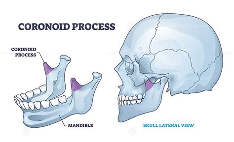 Coronoid Process Anatomy With Isolated Bone And Skull View Outline
