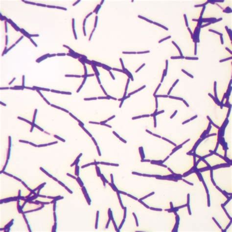 Gram Positive Bacillus Slide Wm Gram Stain