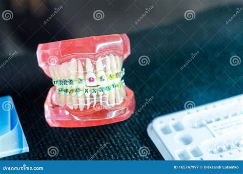 Demonstration Teeth Model Of Orthodontic Bracket Or Brace Stock Image Image Of Dentist Braces