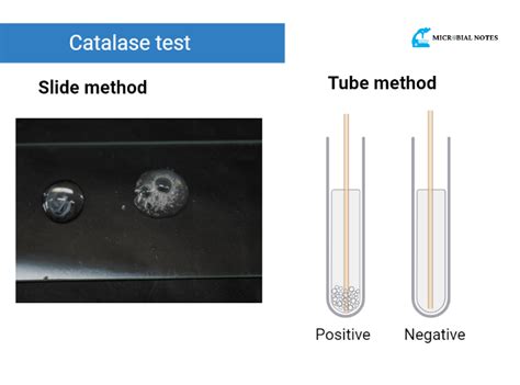Catalase Test Procedure Principle And Uses Medical Test Technology