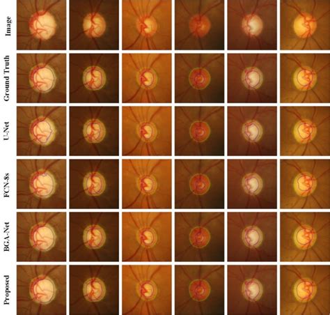 Visualization Of Optic Disc And Optic Cup Segmentation Results In The