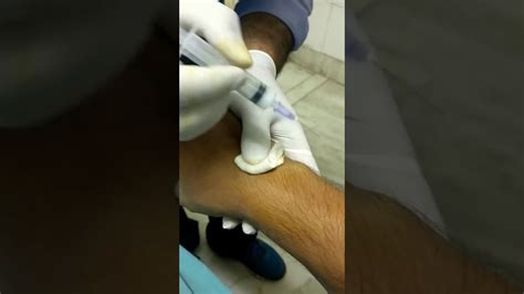 Injection In Wrist Joints Depo Medrol Youtube