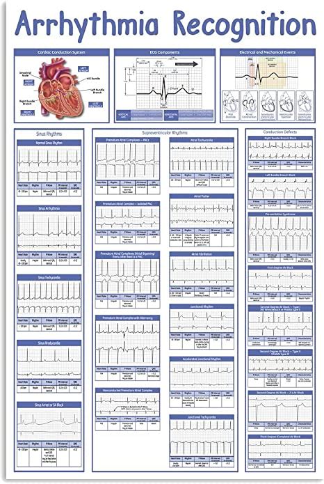 Arrhythmia Recognition Infographic Metal Tin Signs Heart Disease