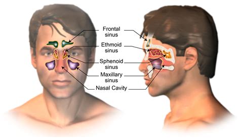 Nasal Cancer Cancerwalls