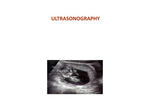 Ppt Ultrasonography Powerpoint Presentation Free Download Id9100948