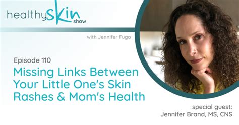 110 Missing Links Between Your Little Ones Skin Rashes And Moms Health