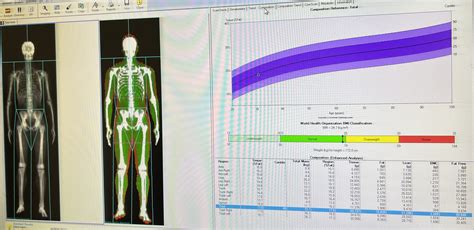How Much Dexa Body Scan Costs And Is It Worth It Azure Medical