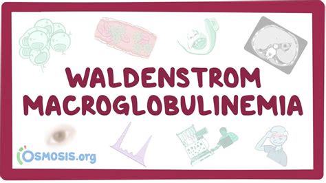 Waldenstrom Macroglobulinemia Video And Anatomy Osmosis