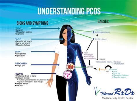 Think You Have Pcos Understand Pcos Risks Symptoms Complications Diagnosis Treatment