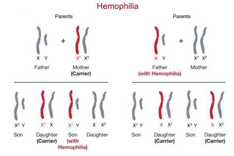 In drosophila, several genes determine eye color. Learn About Sex-Linked Traits and Disorders