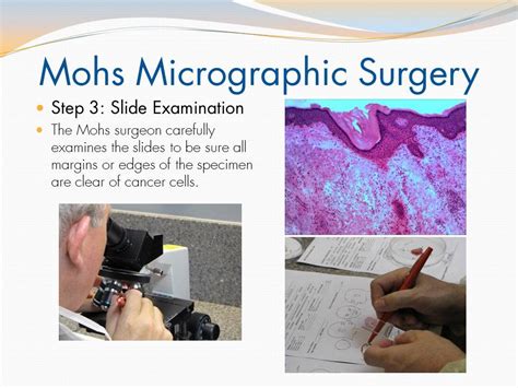 Mohs Micrographic Surgery Day Youtube