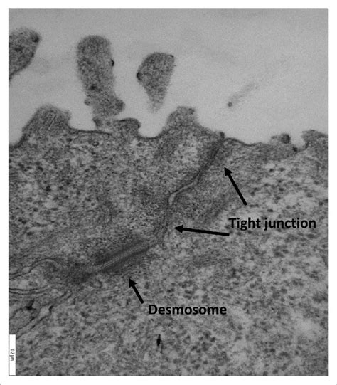 Epithelial Junctions Transmission Electron Microscopy Of Junctional