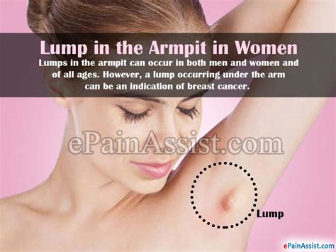 Is Armpit Pain A Sign Of Breast Cancer Early Signs Of Breast Cancer