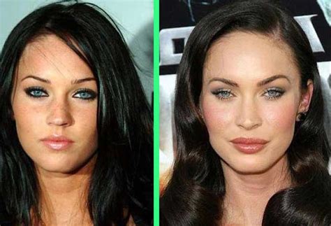 Megan Fox Before And After Plastic Surgery Boob Job And Lifting