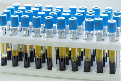 Lab Blood Test Tubes In Holder On Table In Laboratory Medical