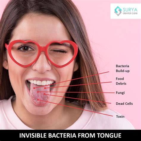 Bacteria Dead Cells Food Debris And Other Microorganisms Stuck In Between The Tongue Papillae