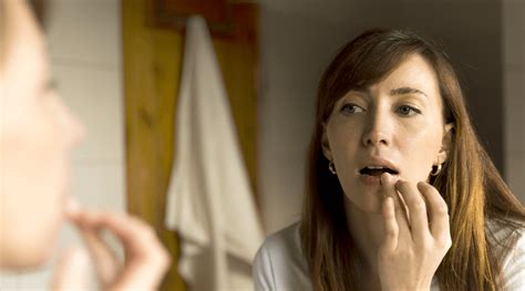 How To Treat Cracked Lip Corners