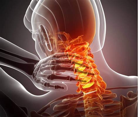 Neck Pain Scottsdale Az Orthopedic Spine Surgery