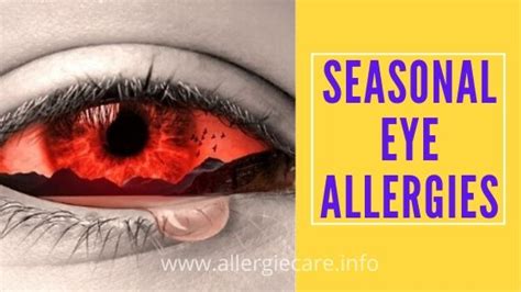 Seasonal Eye Allergies Sign Remedy The Best Way To Care Allergie Care