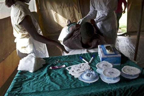 Hiv Battle Uganda Tests Out Rubber Band Circumcision Nation