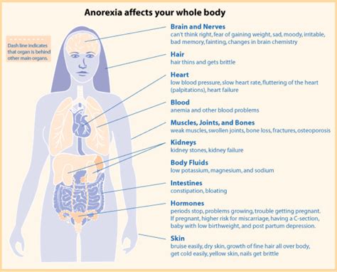 Complications Anorexia Nervosa