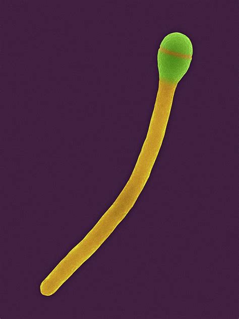 Clostridium Phytofermentans Photograph By Dennis Kunkel Microscopy