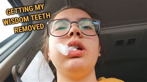 Getting My Wisdom Teeth Removed Youtube