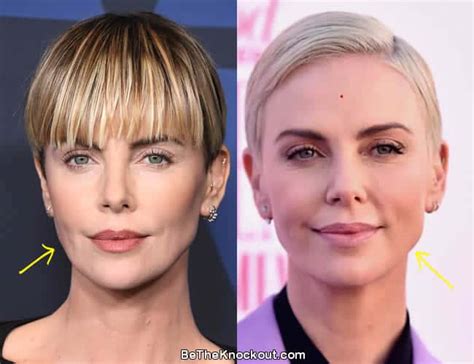 Charlize Theron Plastic Surgery Before And After Pict Vrogue Co