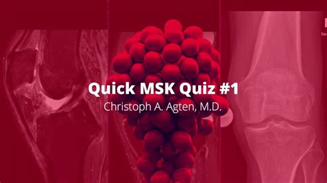 Solve This Msk Case New Quiz Series Youtube