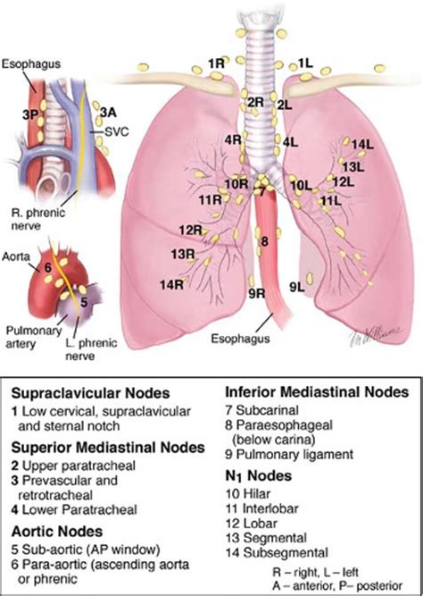 Pulmonary Resection Basicmedical Key