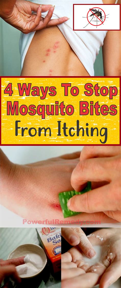 4 Ways To Stop Mosquito Bites From Itching Insect Bite Remedy Natural Mosquito Bite Remedy
