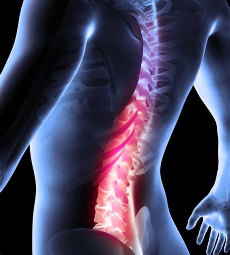 Lower back pain can be caused by problems with the internal organs. How to Effectively Treat Lower Back Pain | All American ...