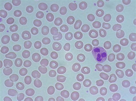 Granulocytes And Granulocyte Maturation A Laboratory Guide To