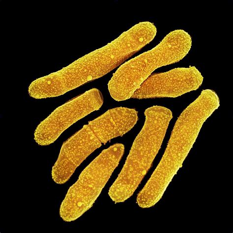 Cosas Sorprendentes Que No Sab As Sobre Las Bacterias 14045 The Best