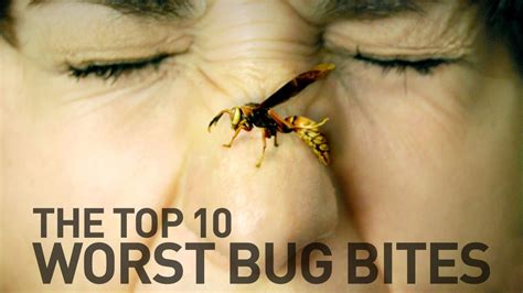 Top 10 Most Painful Bug Bites And Stings Youtube