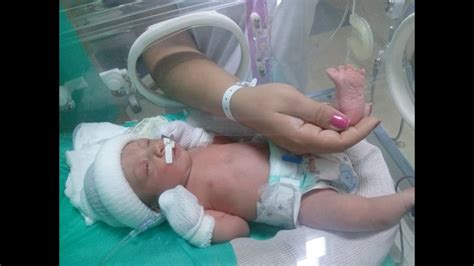 Barriga Dura Com 35 Semanas De Gestação