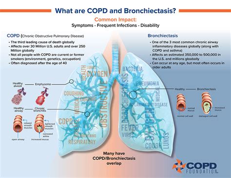 Bronchiectasis Diagram