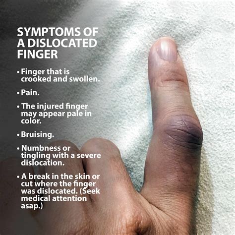 How To Heal A Dislocated Finger - Dreamopportunity25